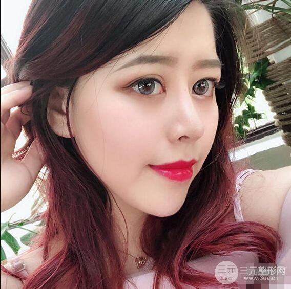 重慶華美何春濤硅膠隆鼻前后對比圖 內(nèi)附恢復(fù)心情小札