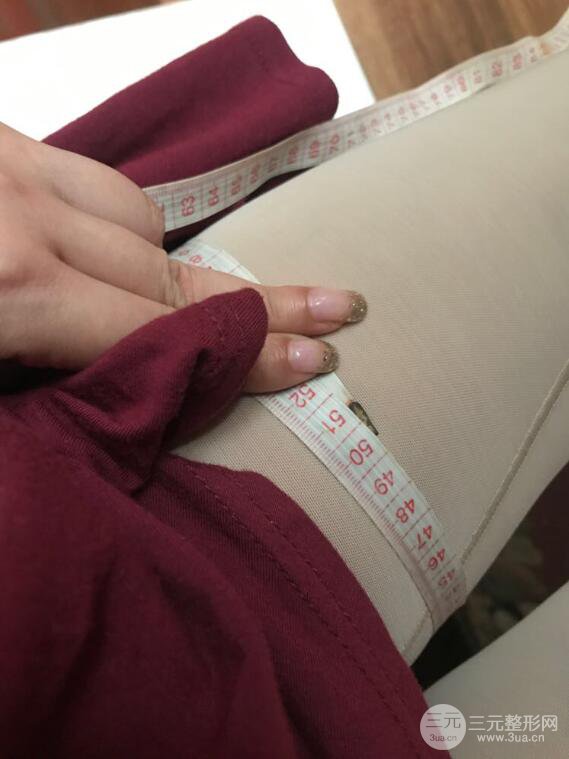 德陽(yáng)東美奧克拉楊華博大腿吸脂前對(duì)對(duì)比圖 四個(gè)月恢復(fù)變化小記