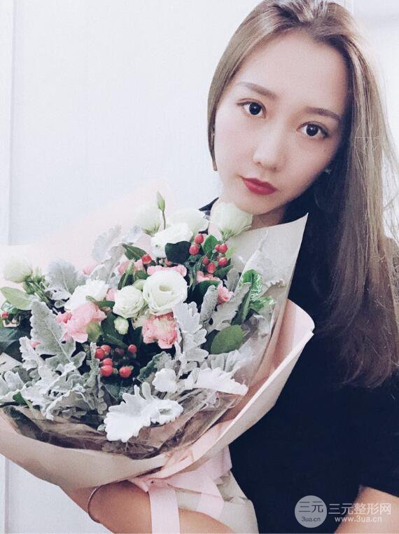 哈醫(yī)大二院整形科肖志波全切雙眼皮前后對(duì)比圖 真實(shí)恢復(fù)經(jīng)歷日記