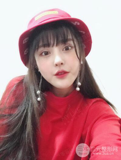 北京美萊趙峻賢隆鼻整形真實案例對比圖恢復過程分享