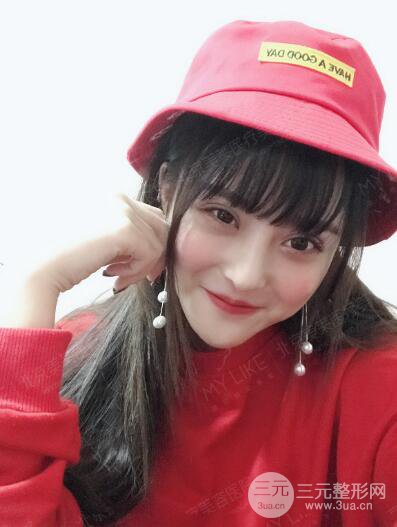 北京美萊趙峻賢隆鼻整形真實案例對比圖恢復過程分享