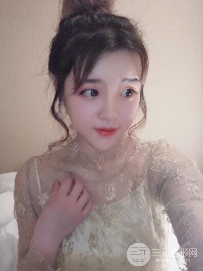 成都天使之翼張勁松切開雙眼皮案例前后對比圖心情小札