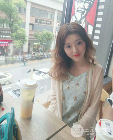 成都天使之翼張勁松切開雙眼皮案例前后對比圖心情小札