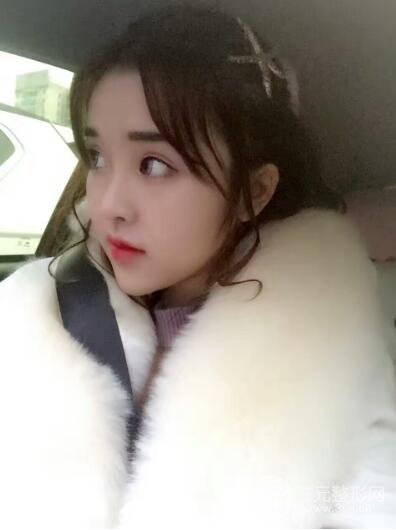 成都天使之翼張勁松切開雙眼皮案例前后對比圖心情小札