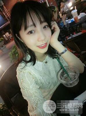 杭州華山連天美高俊明雙眼皮案例前后對比圖心情分享