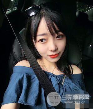 杭州華山連天美高俊明雙眼皮案例前后對比圖心情分享