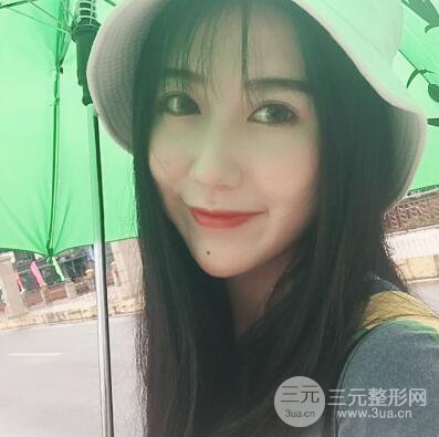 合肥壹加壹王大勇假體隆鼻果對比圖 45天恢復(fù)心路歷程