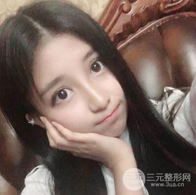 沈陽(yáng)軍區(qū)總醫(yī)院時(shí)杰切開雙眼皮案例對(duì)比圖|內(nèi)附心情恢復(fù)小札哦