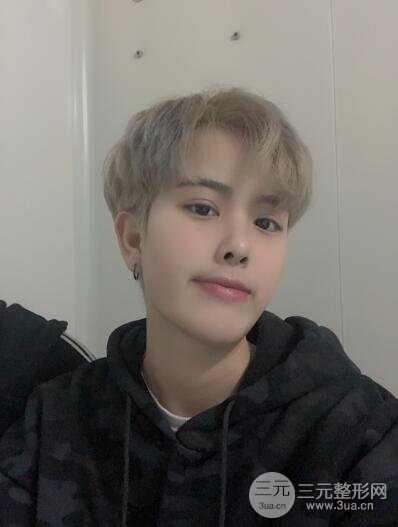 哈醫(yī)大二院整形科肖志波割雙眼皮對比圖男性案例