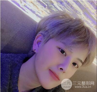哈醫(yī)大二院整形科肖志波割雙眼皮對比圖男性案例