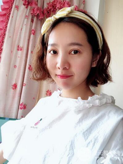 湘潭華美切開(kāi)雙眼皮案例對(duì)照?qǐng)D兩個(gè)月恢復(fù)過(guò)程心情日扎