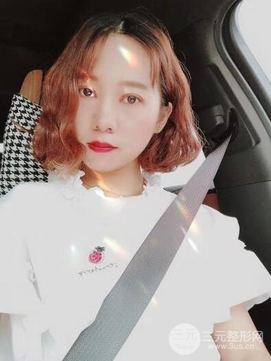 湘潭華美切開(kāi)雙眼皮案例對(duì)照?qǐng)D兩個(gè)月恢復(fù)過(guò)程心情日扎