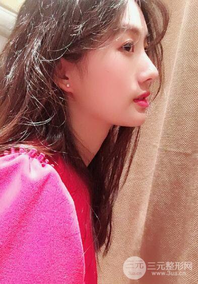 蘇州紫馨孫影塌鼻子假體隆鼻案例對(duì)比照心情小札