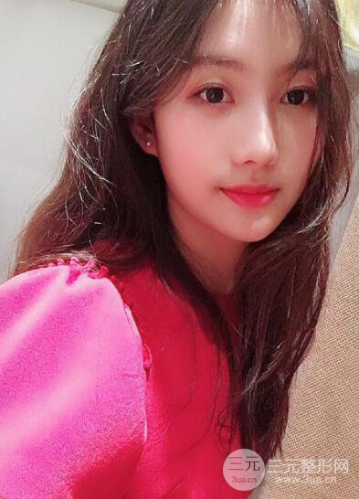 蘇州紫馨孫影塌鼻子假體隆鼻案例對(duì)比照心情小札