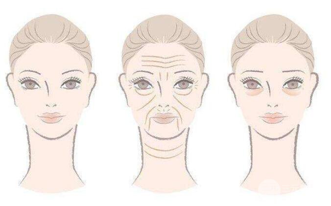 去魚尾紋一般要多少錢呢?影響價格的因素有哪些?