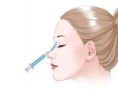 北京注射隆鼻修復(fù)需要多少錢?影響價格的因素有哪些?