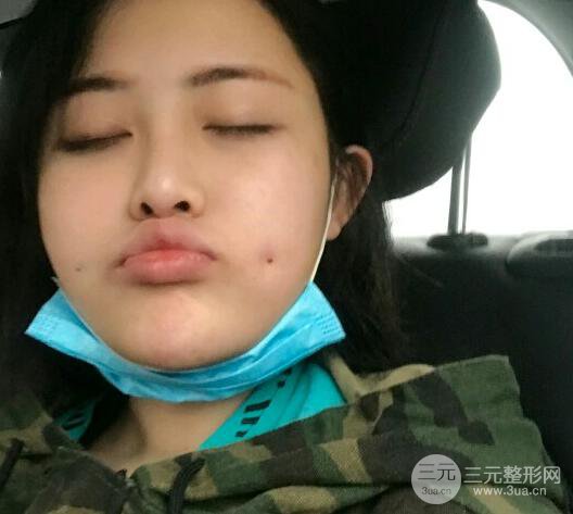 重慶華美酒窩整形價(jià)格