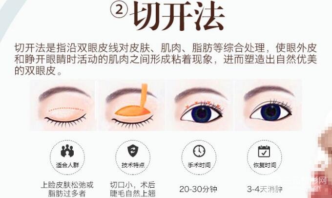 切開雙眼皮手術(shù)原理