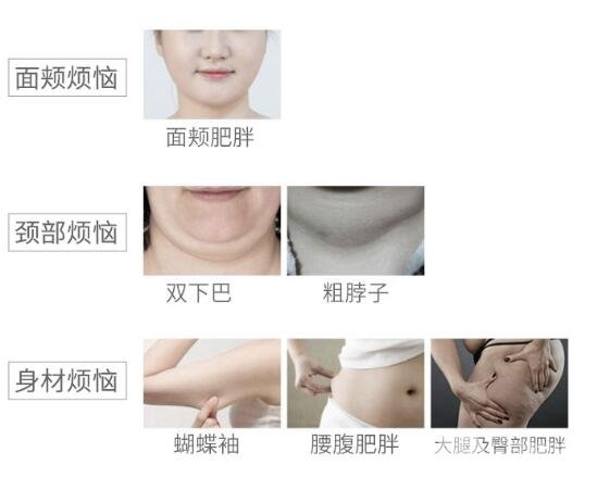 注射溶脂適合部位