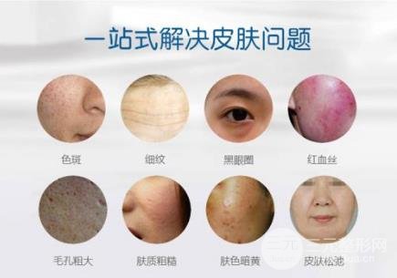 光子嫩膚哪家醫(yī)院好 謹(jǐn)記這幾點(diǎn)很重要~