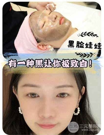 做黑臉娃娃后的注意事項(xiàng)