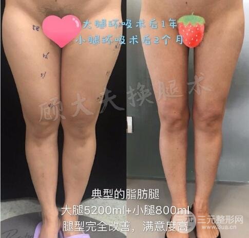 如何避免風(fēng)險(xiǎn)和副作用