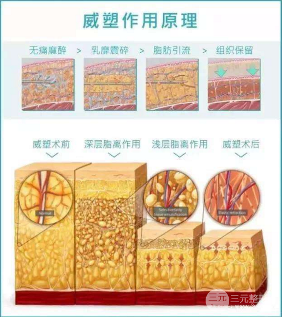 威塑抽脂有什么不同