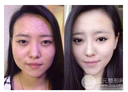 圓臉怎樣變瓜子臉