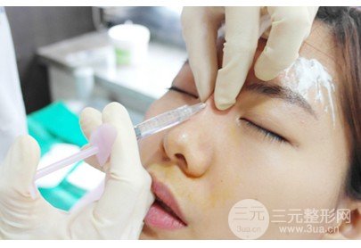 不開(kāi)刀隆鼻是什么技術(shù)