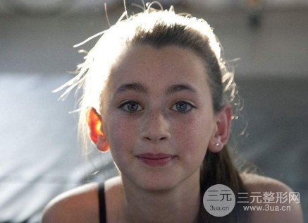 激光祛斑一次多少錢