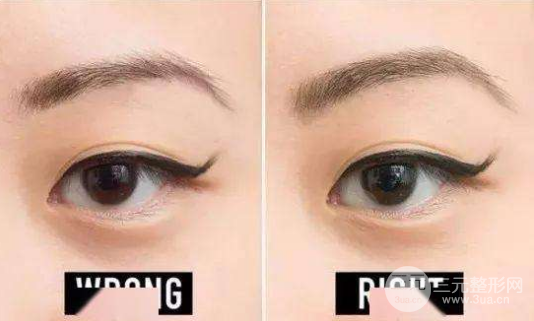 種植眉毛前后圖片