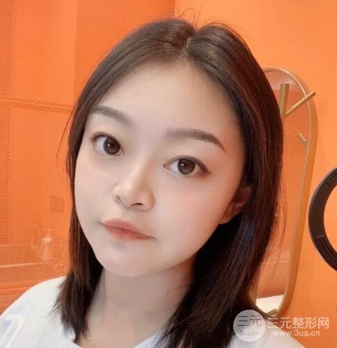 紋眉手術(shù)后