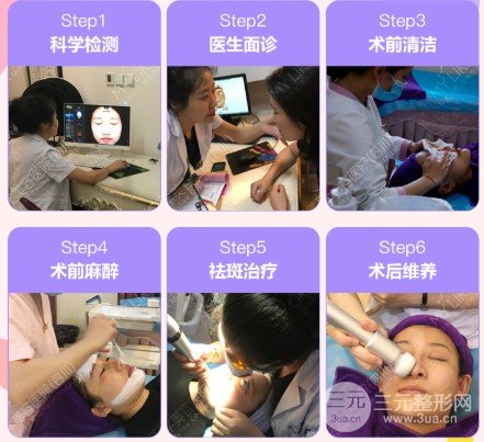 激光祛黃褐斑幾次