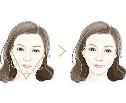 什么是微創(chuàng)改臉型