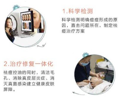 光子祛痘印多少錢一次