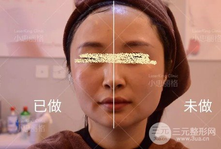 做了第新一代熱瑪吉