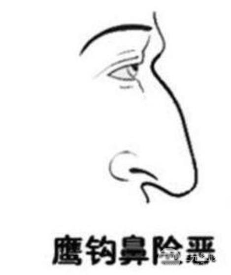 鷹鉤鼻整形手術(shù)有哪些方法?