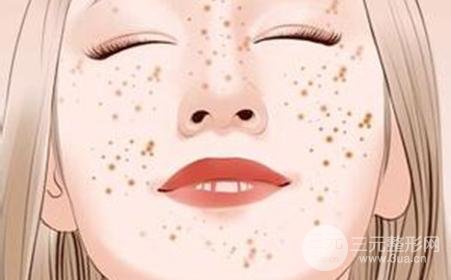 臉上色斑如何去除