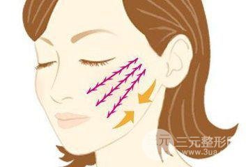 中面部除皺術(shù)后遺癥有哪些