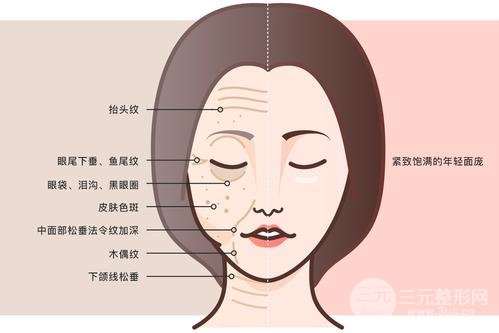 中面部除皺術(shù)