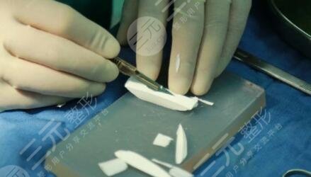 進(jìn)口膨體隆鼻有哪些牌子?品牌大盤點(diǎn)