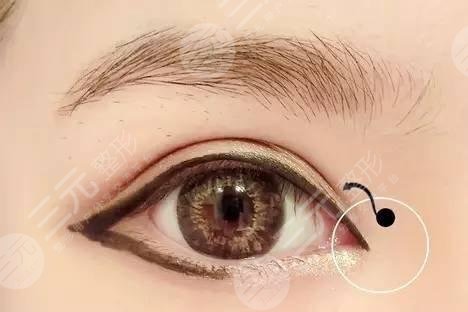 開眼角有哪幾種方法