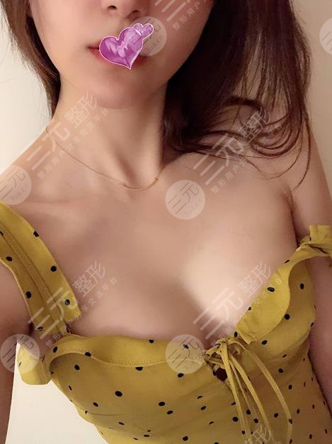 林沸騰醫(yī)生隆胸圖片