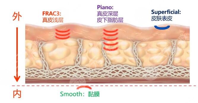 手術(shù)緩解基本原理