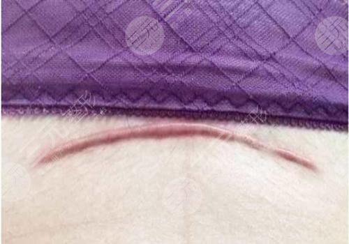 濟(jì)南歐洲之星點(diǎn)陣激光的作用