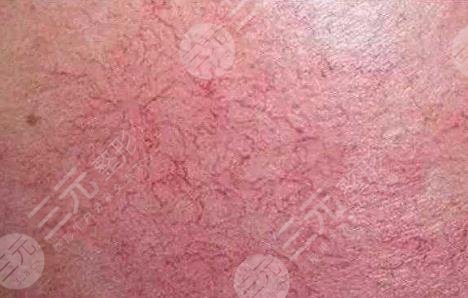 濟(jì)南歐洲之星點(diǎn)陣激光果