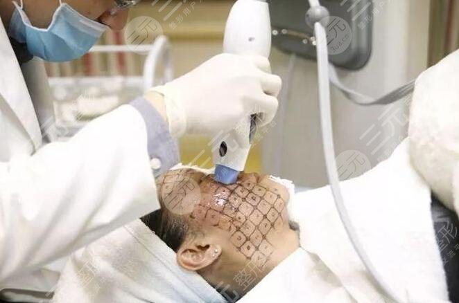 熱瑪吉一次管多久？