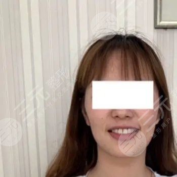 美容冠真實圖片