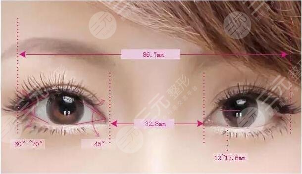 8mm雙眼皮恢復后是多寬