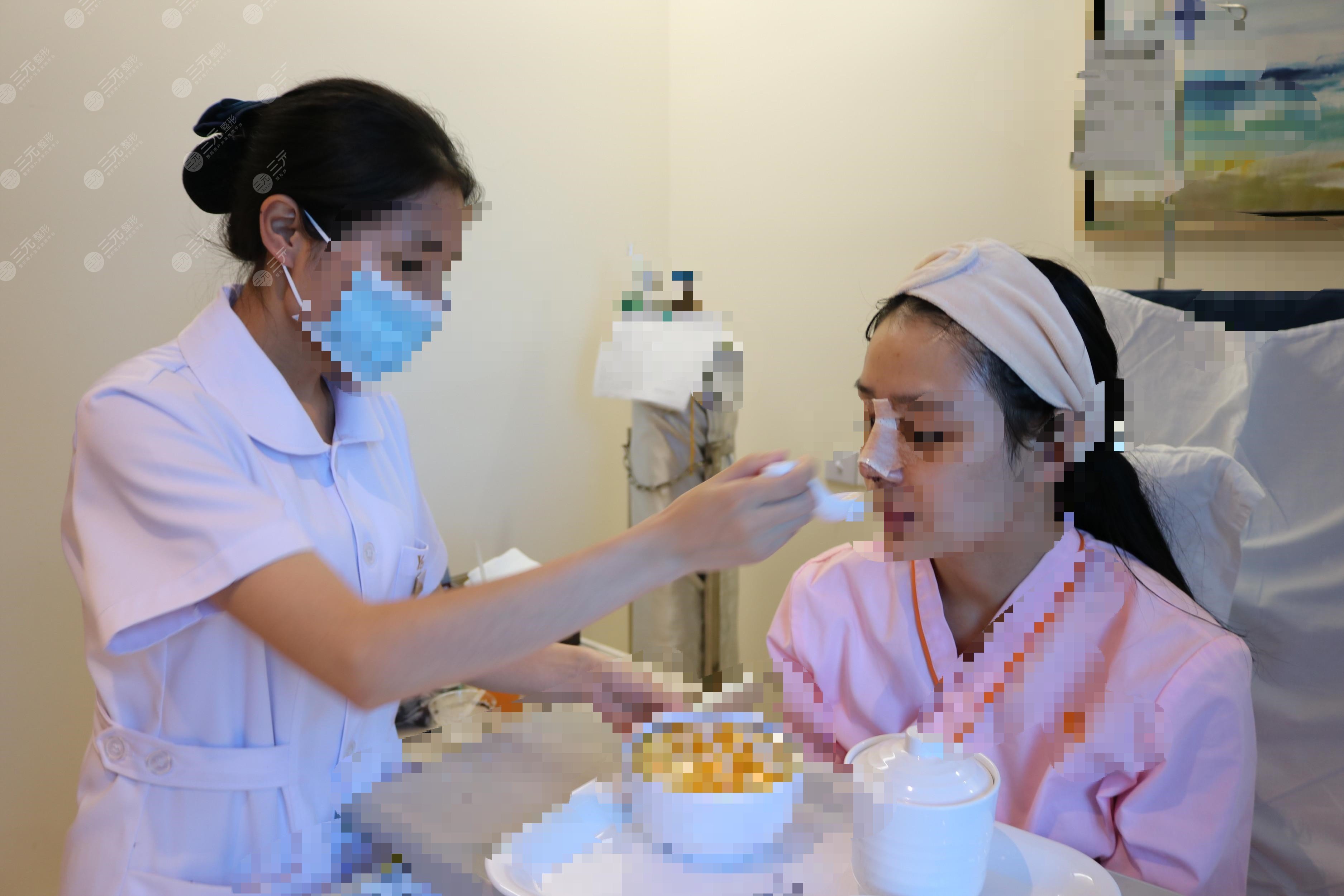 隆鼻前后對(duì)比果圖片